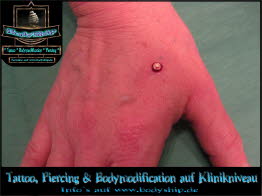 Hand weiblich Dermal Anchor Microdermal Glitzer Piercing Bodymod by Bodyship Halle - Sachsen Anhalt - www
