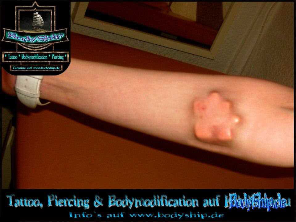 Subdermal-Puzzle-Implantat-under-Skin-unter-der-Haut-PTFE-Teflon-Frau-weiblich-Bodymod-Bodymodification-by-Bodyship-Halle-Deutschland---Sachsen-Anhalt---www