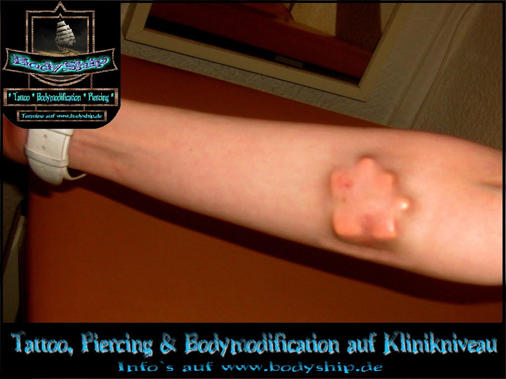 Subdermal Puzzle Implantat under Skin unter der Haut PTFE Teflon Frau weiblich Bodymod Bodymodification by Bodyship Halle Deutschland - Sachsen Anhalt - www