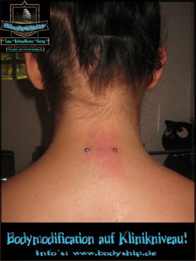 Surface Nacken Piercing Bodymod by Bodyship Halle - Sachsen Anhalt - www