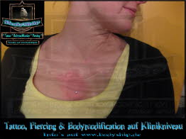 Dekolette Brust Busen weiblich Dermal Anchor Microdermal Glitzer Piercing Bodymod by Bodyship Halle - Sachsen Anhalt - www