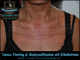 Dekolette Brust Busen weiblich Dermal Anchor Microdermal Glitzer Piercing Bodymod by Bodyship Halle - Sachsen Anhalt - www