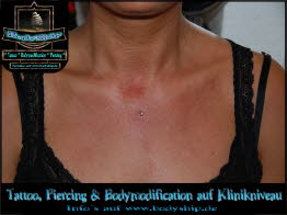 Dekolette Brust Busen weiblich Dermal Anchor Microdermal Glitzer Piercing Bodymod by Bodyship Halle - Sachsen Anhalt - www