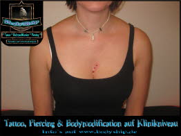 Drei 3 Implantate im Dekolette Brust Busen weiblich Dermal Anchor Microdermal Glitzer Piercing Bodymod by Bodyship Halle - Sachsen Anhalt - www