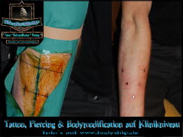 Vendetta V Formation Platte 5 Dermal Anchor Microdermal Glitzer Piercing Bodymod by Bodyship Halle - Sachsen Anhalt - www