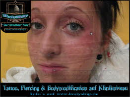 am Auge Skin Face weiblich Dermal Anchor Microdermal Glitzer Piercing Bodymod by Bodyship Halle - Sachsen Anhalt - www
